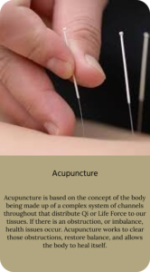 acupuncture needles being inserted into back
