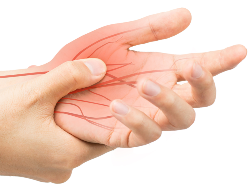 Peripheral Nerve Impingement