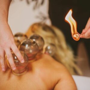 acupuncturist using fire cupping on woman's back